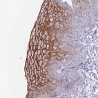 Immunohistochemical staining of human esophagus shows strong membranous positivity in squamous epithelial cells.