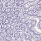 Immunohistochemical staining of human duodenum shows no membranous positivity in glandular cells as expected.