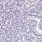 Immunohistochemical staining of human duodenum shows no membranous positivity in glandular cells as expected.