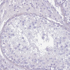 Immunohistochemical staining of human testis shows no positivity in cells in seminiferous ducts as expected.