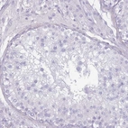 Immunohistochemical staining of human testis shows no positivity in cells in seminiferous ducts as expected.