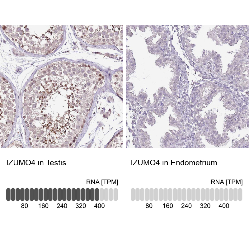 Anti-IZUMO4 Antibody