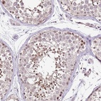 Immunohistochemical staining of human testis shows high expression.