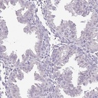Immunohistochemical staining of human endometrium shows low expression as expected.