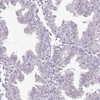 Immunohistochemical staining of human endometrium shows low expression as expected.