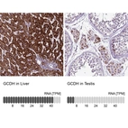 Anti-GCDH Antibody