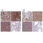 Immunohistochemical staining of human kidney, liver, pancreas and testis using Anti-GCDH antibody HPA048492 (A) shows similar protein distribution across tissues to independent antibody HPA043252 (B).