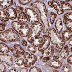 Immunohistochemical staining of human kidney shows moderate to strong positivity in mitochondria in cells in tubules.