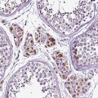 Immunohistochemical staining of human testis shows moderate to strong positivity in mitochondria in Leydig cells.