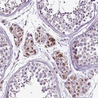 Immunohistochemical staining of human testis shows moderate to strong positivity in mitochondria in Leydig cells.