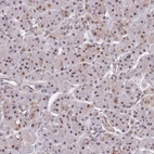 Anti-SNRPA1 Antibody