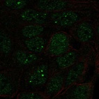 Immunofluorescent staining of human cell line RT4 shows localization to nucleoplasm & nuclear bodies.