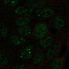 Immunofluorescent staining of human cell line RT4 shows localization to nucleoplasm & nuclear bodies.