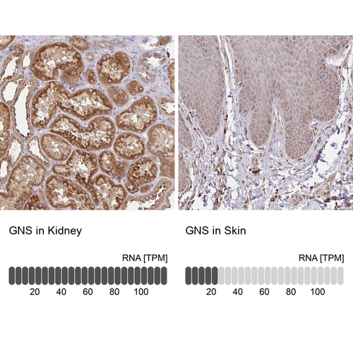 Anti-GNS Human Protein Atlas Antibody