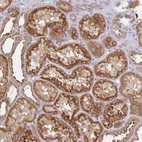 Immunohistochemical staining of human kidney shows strong granular cytoplasmic positivity in cells in tubules.