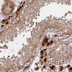Immunohistochemical staining of human testis shows strong granular cytoplasmic positivity in Leydig cells and in cells in seminiferous ducts.