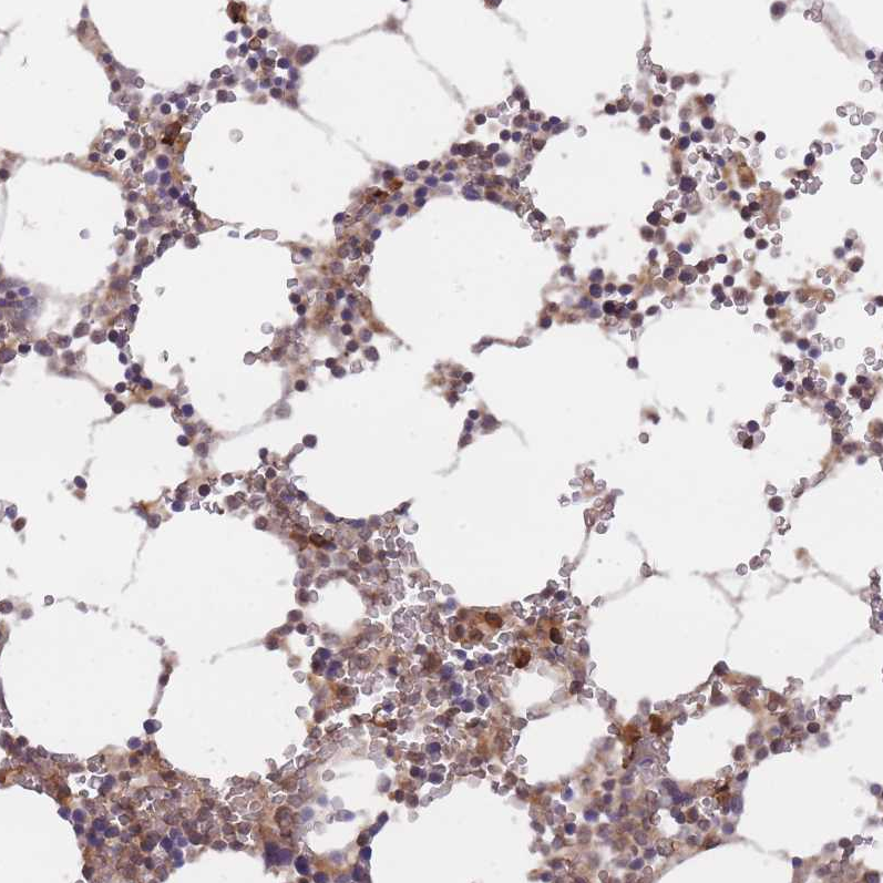 Anti-TMEM55B Antibody