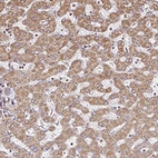 Immunohistochemical staining of human liver shows moderate granular cytoplasmic positivity in hepatocytes.