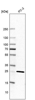 Anti-TMEM55B Antibody