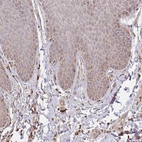 Immunohistochemical staining of human skin shows very weak cytoplasmic positivity in squamous epithelial cells.