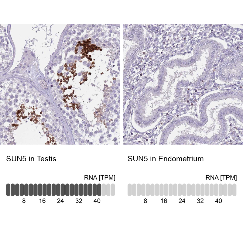 Anti-SUN5 Antibody