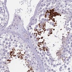 Immunohistochemical staining of human testis shows high expression.