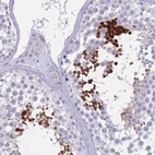 Immunohistochemical staining of human testis shows high expression.