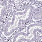 Immunohistochemical staining of human endometrium shows low expression as expected.