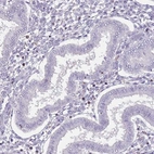 Immunohistochemical staining of human endometrium shows low expression as expected.