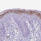 Anti-CLEC2A Antibody