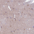 Immunohistochemical staining of human cerebral cortex shows weak cytoplasmic positivity in glial cells.