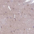 Immunohistochemical staining of human cerebral cortex shows weak cytoplasmic positivity in glial cells.