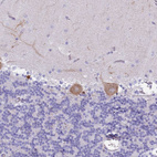 Immunohistochemical staining of human cerebellum shows weak to moderate cytoplasmic positivity in Purkinje cells.
