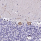 Immunohistochemical staining of human cerebellum shows weak to moderate cytoplasmic positivity in Purkinje cells.
