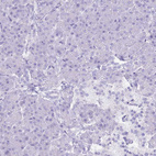 Immunohistochemical staining of human pancreas shows no positivity in exocrine glandular cells as expected.