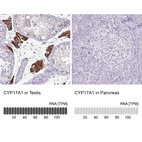 Anti-CYP17A1 Antibody