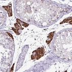 Immunohistochemical staining of human testis shows strong cytoplasmic positivity in Leydig cells.