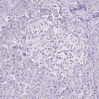 Immunohistochemical staining of human pancreas shows no positivity in exocrine glandular cells.