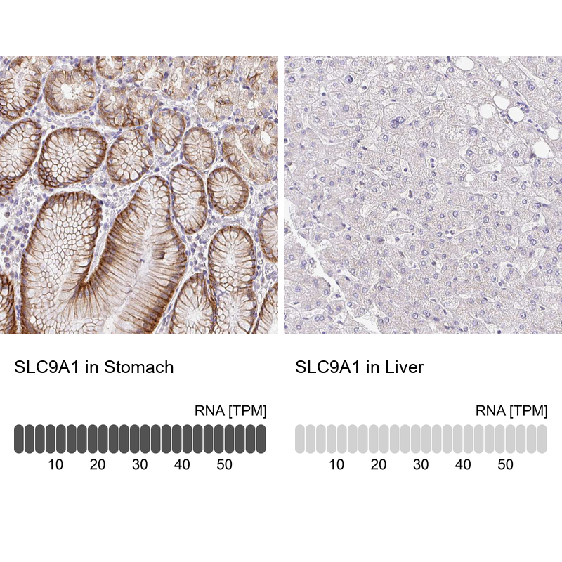 Anti-SLC9A1 Antibody