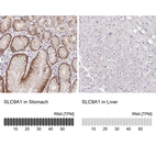 Anti-SLC9A1 Antibody