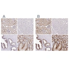 Immunohistochemical staining of human kidney, liver, prostate and stomach using Anti-SLC9A1 antibody HPA048532 (A) shows similar protein distribution across tissues to independent antibody HPA052891 (B).