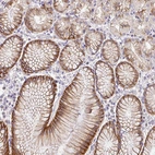 Immunohistochemical staining of human stomach shows moderate membranous/cytoplasmic positivity in glandular cells.