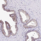 Immunohistochemical staining of human prostate shows moderate membranous/cytoplasmic positivity in glandular cells.
