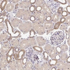 Immunohistochemical staining of human kidney shows moderate membranous/cytoplasmic positivity in cells in tubules.