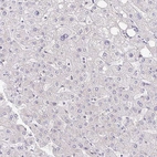 Immunohistochemical staining of human liver shows no positivity in hepatocytes as expected.