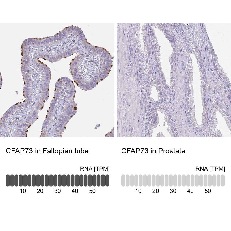 Anti-CFAP73 Antibody