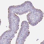 Immunohistochemical staining of human fallopian tube shows high expression.