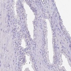 Immunohistochemical staining of human prostate shows low expression as expected.