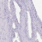 Immunohistochemical staining of human prostate shows low expression as expected.