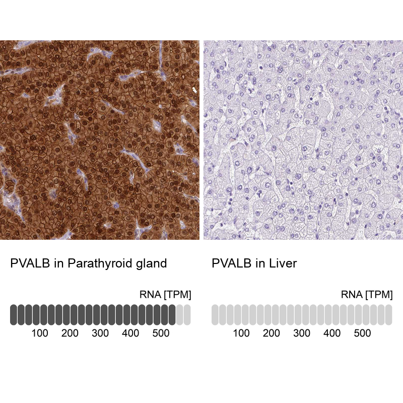 Anti-PVALB Antibody